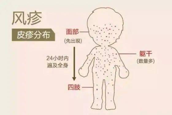 èå®ç¾çå¸¸è¯ å°å¿é£ç¹