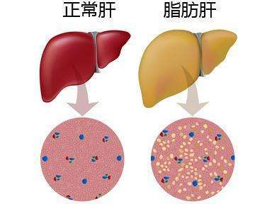 èèªèåä¸ä¸è½å¿½è§,ææ©åå¥½é¢é² 